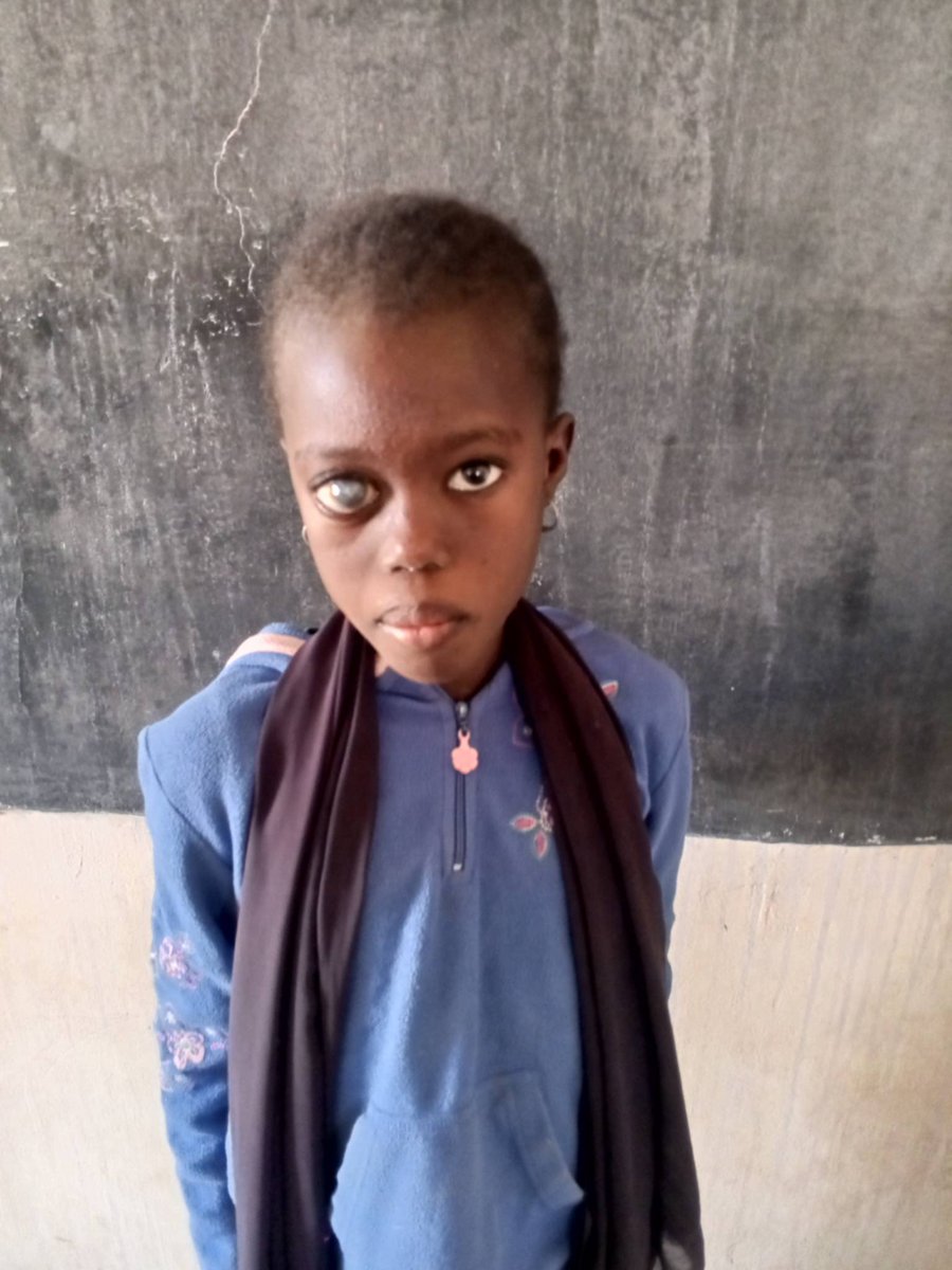 #Ano 

Je me nomme mouhamet sow enseignant à l'ief de Bambey dans la commune de ngoye village Sone kadd. 
Depuis quelque temps, nous sommes à la recherche de bonnes volontés afin d'aider une de nos élèves qui souffre d'une anomalie au niveau de l'oeil droit, qui est une très