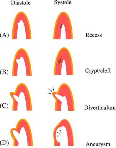 Mehnaz Rahman, M.D. tweet media