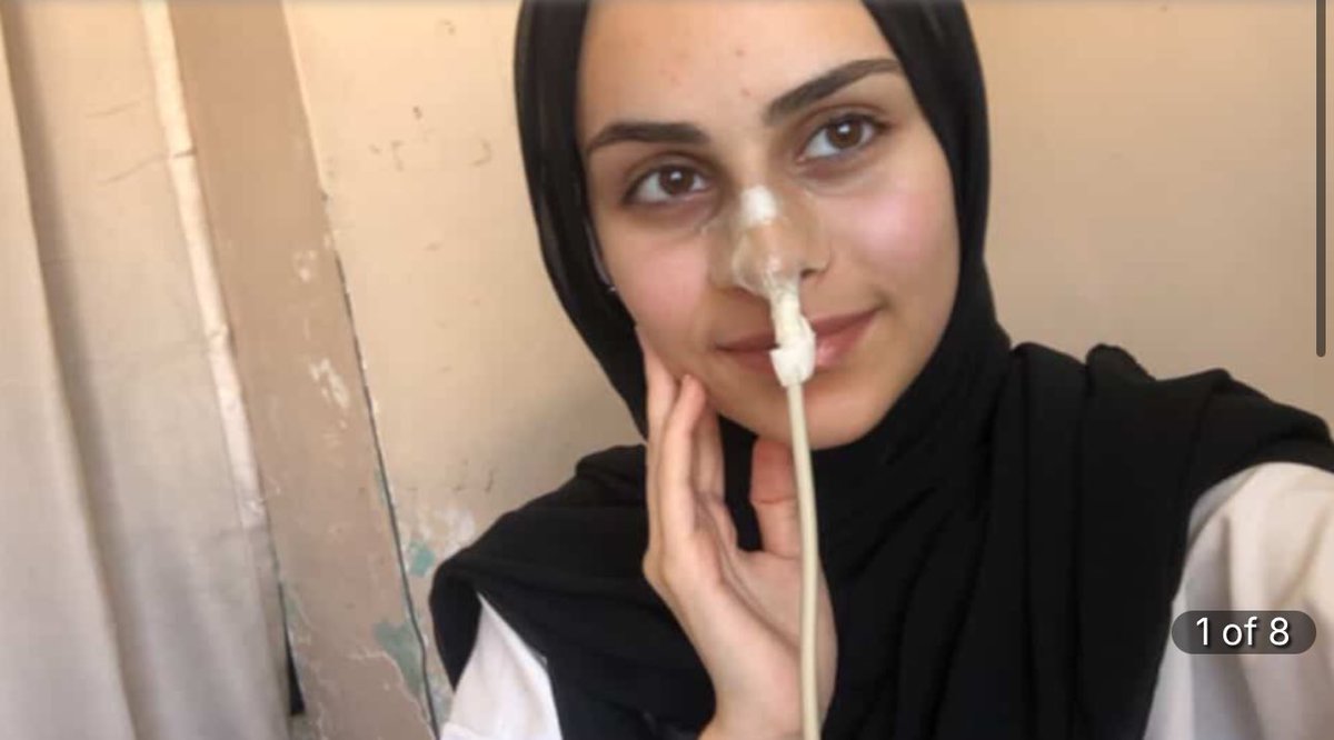 yousef_ki1's tweet image. Rana, 24yrs Palestinian girl.
She is living with a serious chronic illness.
SMA syndrome, a condition that's prevented her from being able to eat.
She suffers from dangerous weight loss. 
She is in need of 4 surgeries, including a total colectomy.

Donate

chuffed.org/project/163796