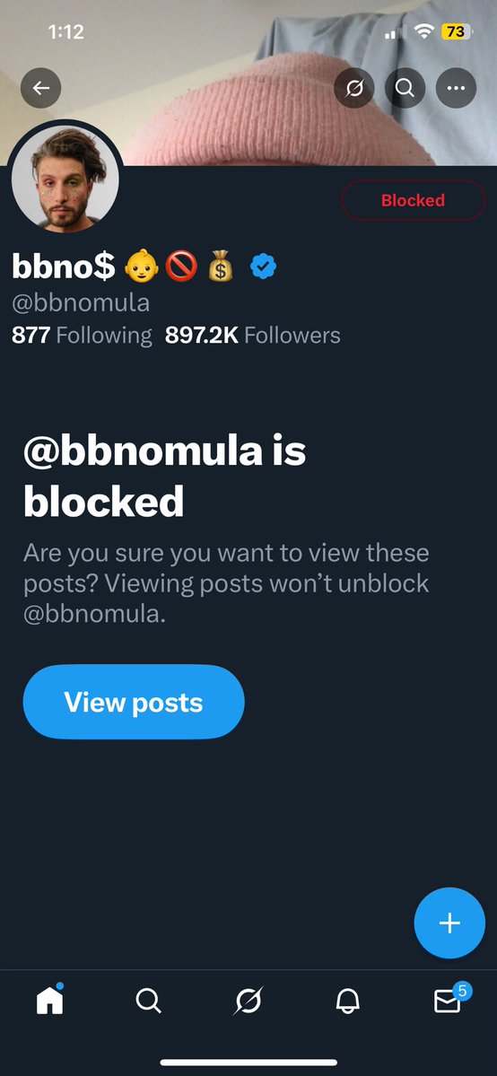 i have a headache so i blocked bbno$