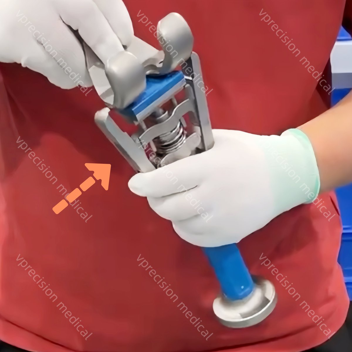 Irisvprecision's tweet image. 😉Hi! Today I will share our 𝙁𝙚𝙢𝙤𝙧𝙖𝙡 𝘾𝙤𝙣𝙙𝙮𝙡𝙚 𝙏𝙧𝙞𝙖𝙡 𝙄𝙣𝙨𝙚𝙧𝙩𝙚𝙧!
How to use: Clamp the femoral condyle trials using the inserter, connect the universal impactor, and fix the trials onto the prepared femoral condyle surface with the knee flexed.
#vprecision