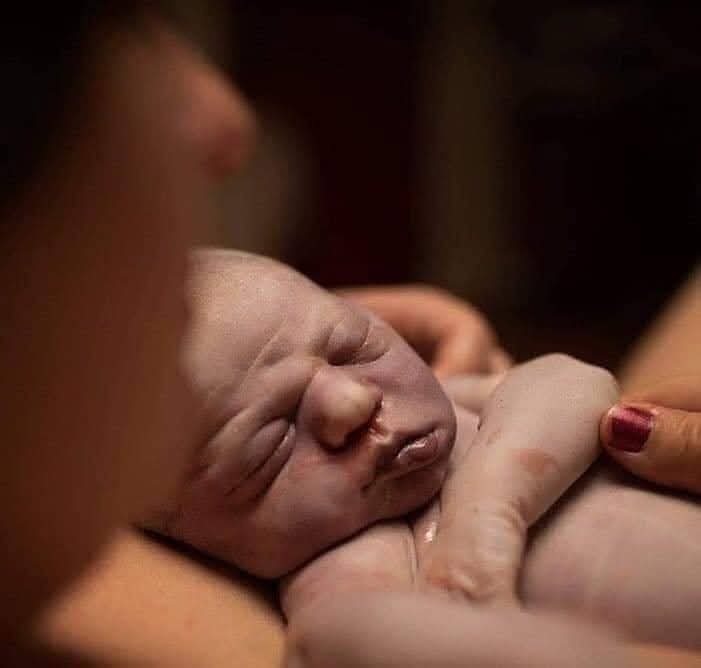 Muerte Perinatal.
"Este bebé falleció antes de nacer. Su madre le parió, le abrazó, le acarició, le besó, le amo... Tenía un tiempo récord en estar con su bebé, en darle todo el amor que quería y podía darle. Sostenerle, sentirle, olerle, conocerle, despedirse le ayuda a vivir el