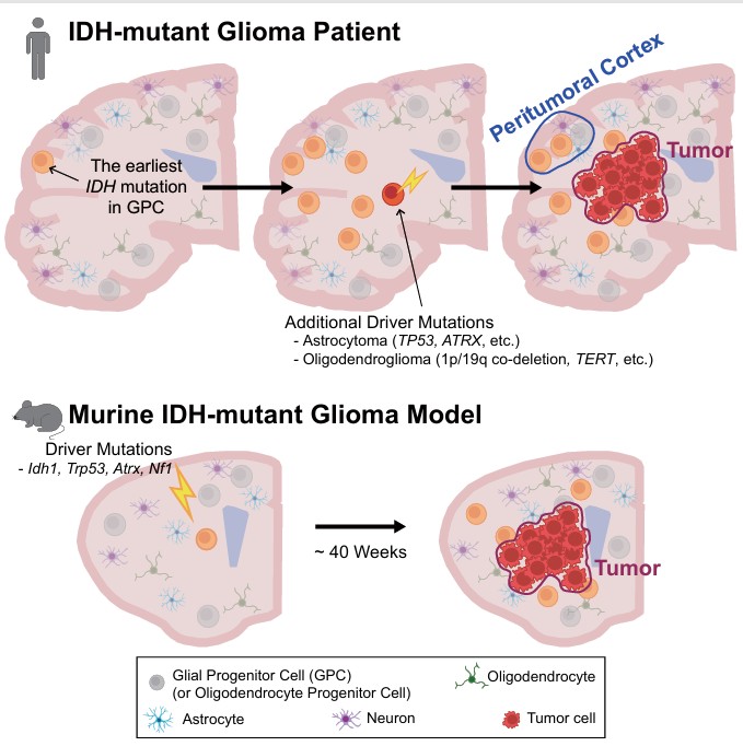 kaistpr's tweet image. 🧠 Breakthrough in brain cancer research
KAIST–Yonsei team reveals that IDH-mutant gliomas originate from glial progenitor cells in normal brain tissue, long before a tumor becomes visible—opening new paths for early diagnosis &amp;amp; recurrence prevention.
#BrainCancer #Glioma #KAIST
