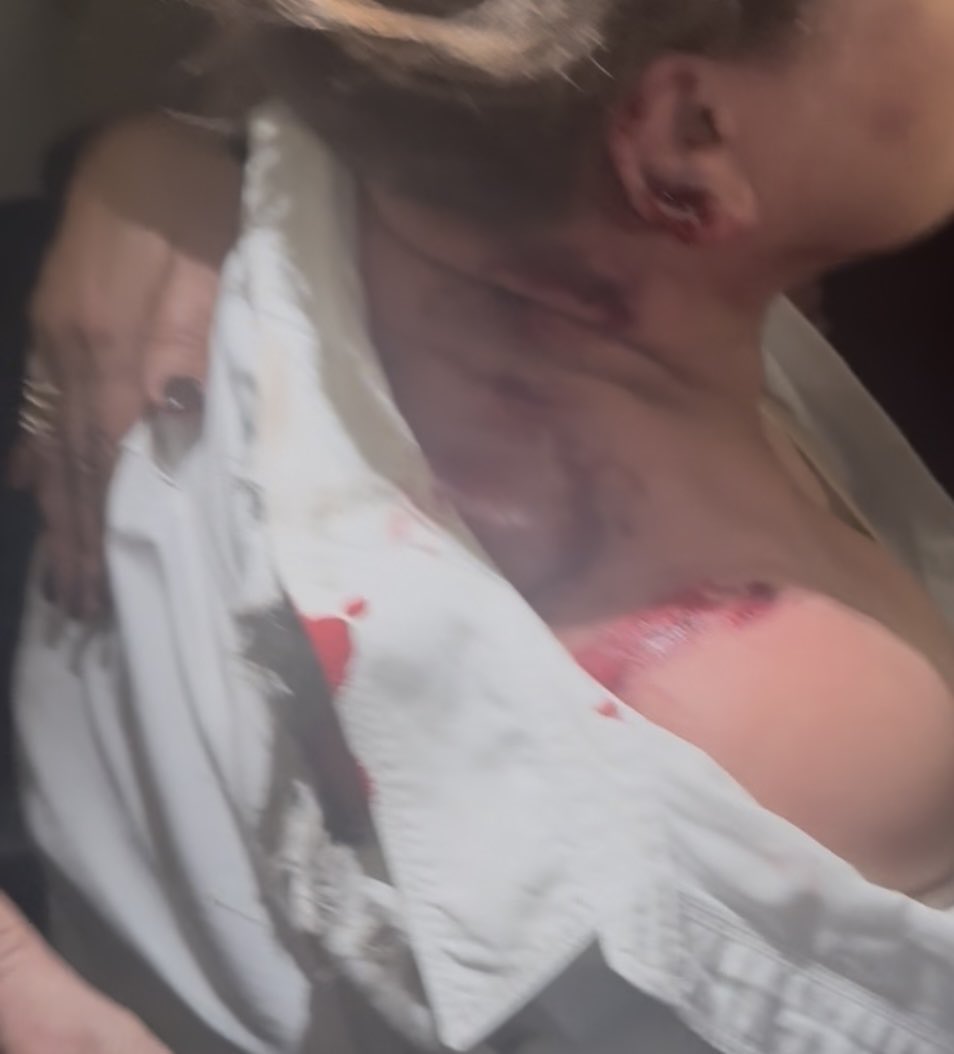 Expresamos nuestra más profunda solidaridad con la compañera Diputada Gladis Aurora López, quien hoy fue víctima de un condenable atentado criminal en el CN.Rechazamos enérgicamente toda forma de violencia que atente contra la vida, la dignidad y los derechos de las mujeres.#🇭🇳