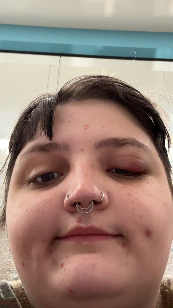 lezbianloser's tweet photo. beautiful pic of me in the waiting room https://t.co/AapbhR8dIY