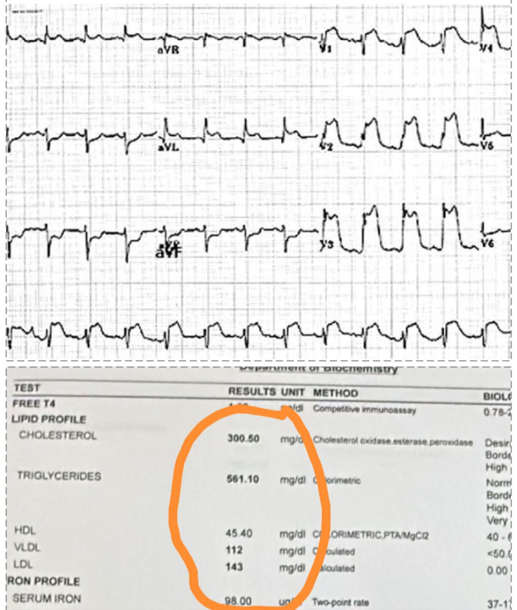 SHE WAS 35, LEAN, AND "HEALTHY." TODAY, SHE’S GONE.

I am looking at the lab results of a woman who should have had 50 more years of life. Instead, I am looking at the reason her heart gave out this morning.

She was the "success" story of our generation. 35 years old, BMI of 20