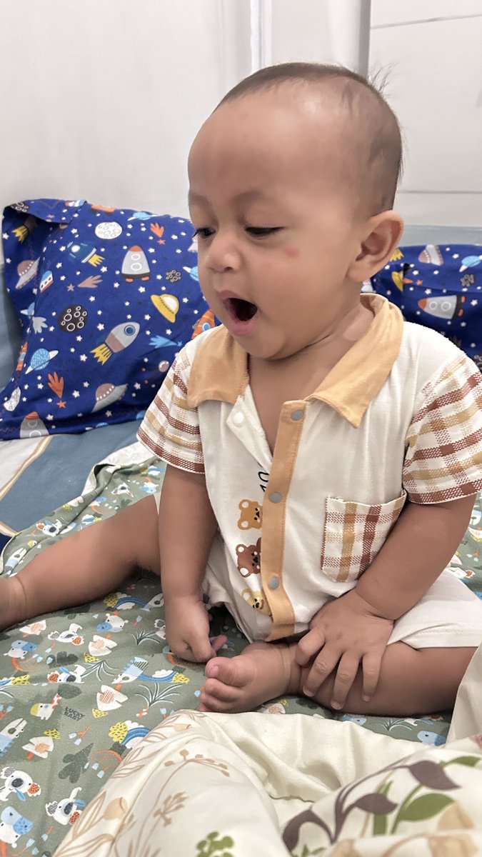 nenestya's tweet photo. Bangun tidur dicium nyamuk https://t.co/qnizBH3buJ