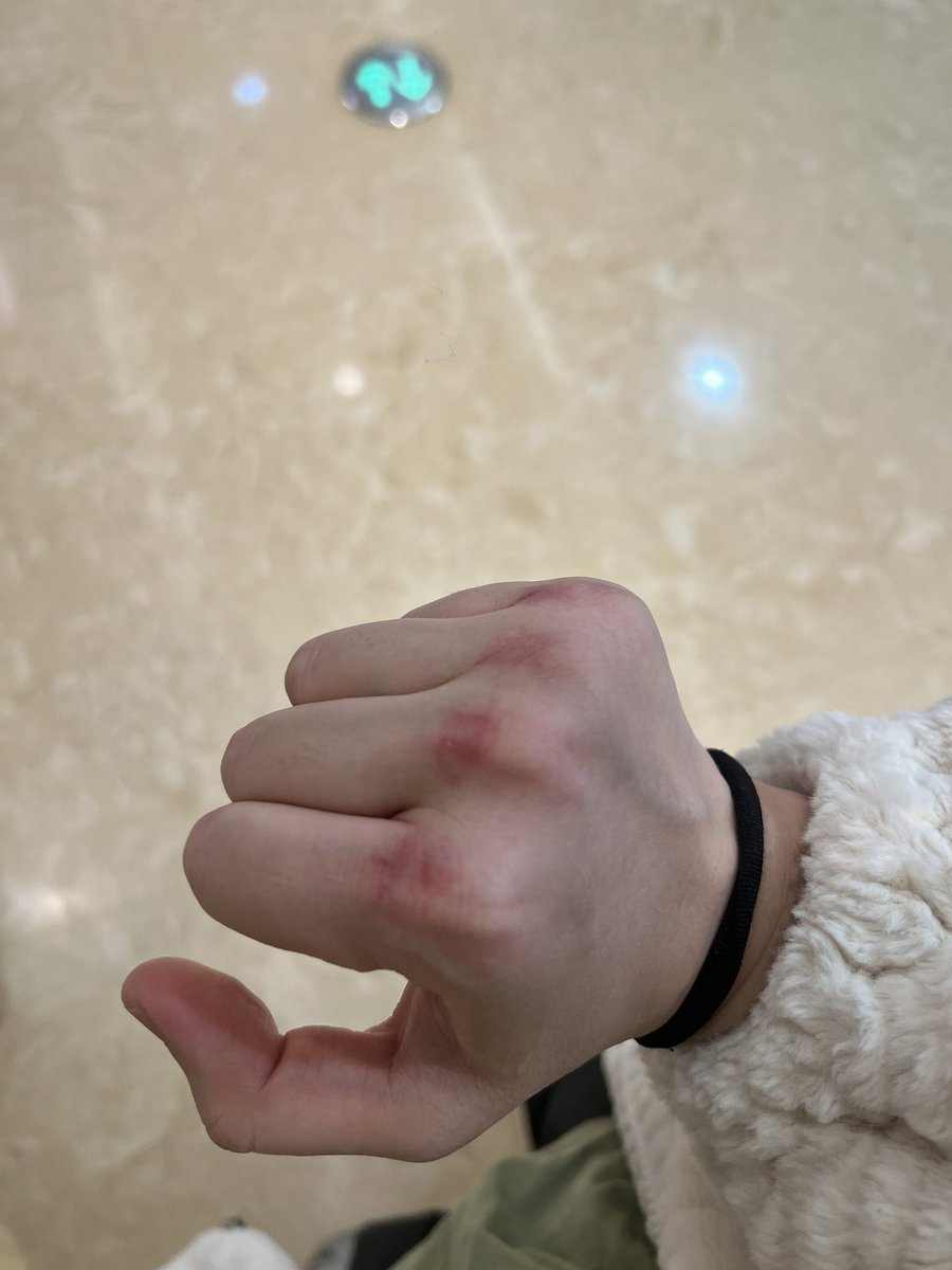 lvlv950404's tweet photo. @xxy01299 谁能让我打下 我刚练了拳击手很痒🥶 https://t.co/bW742Rp8dr