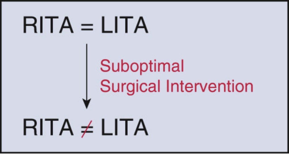 FaisalBakaeen's tweet photo. RITA is identical to LITA, and only the surgeon can interfere with that - The Journal of Thoracic and Cardiovascular Surgery https://t.co/PottE9tsaQ https://t.co/R6eTOBTb98