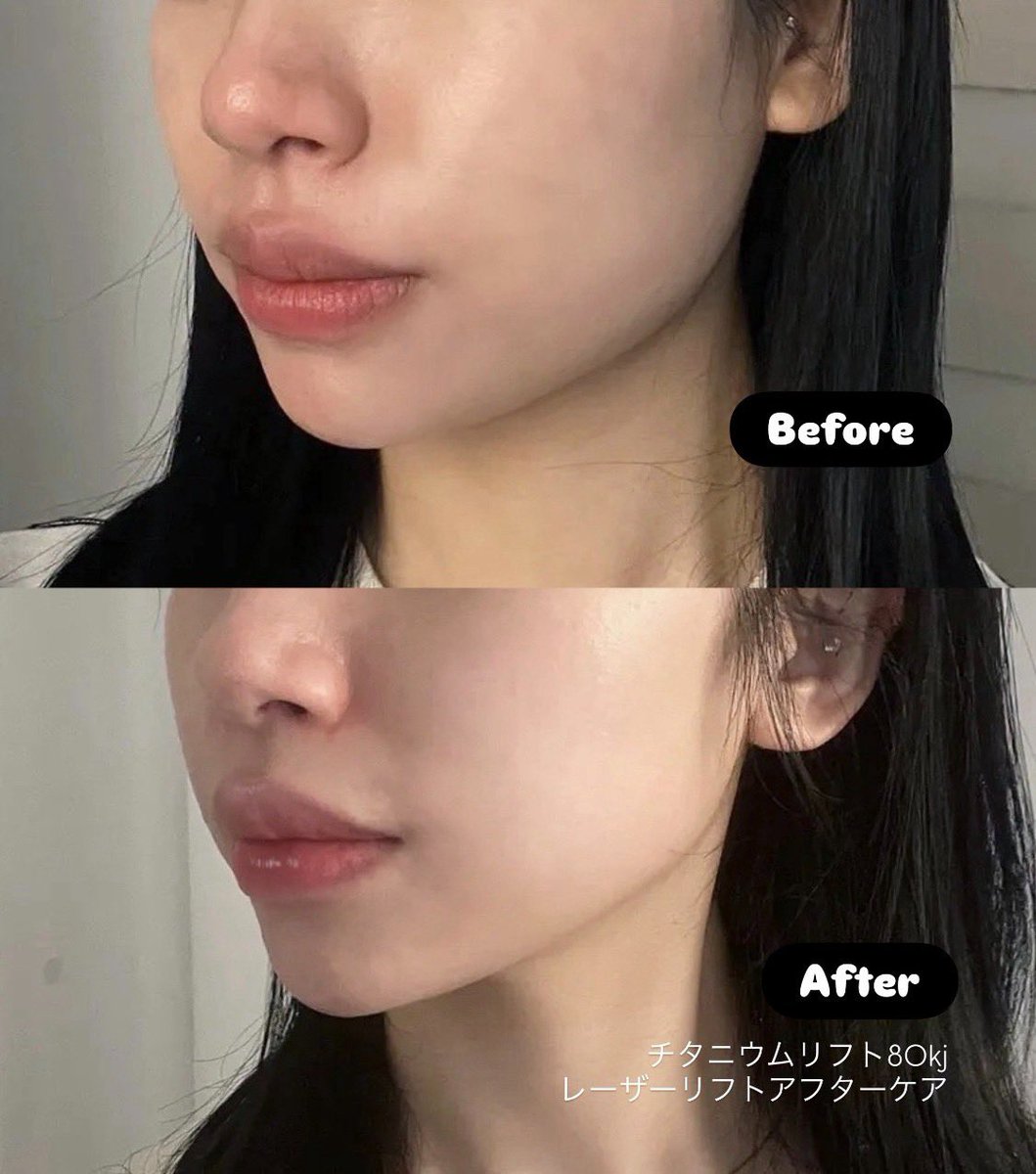 公式】プランエスクリニック（PLAN;SCLINIC） (@plansjp) / Posts / X