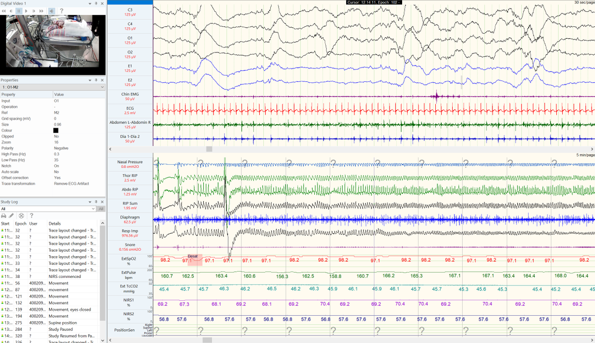 Compumedics tweet media