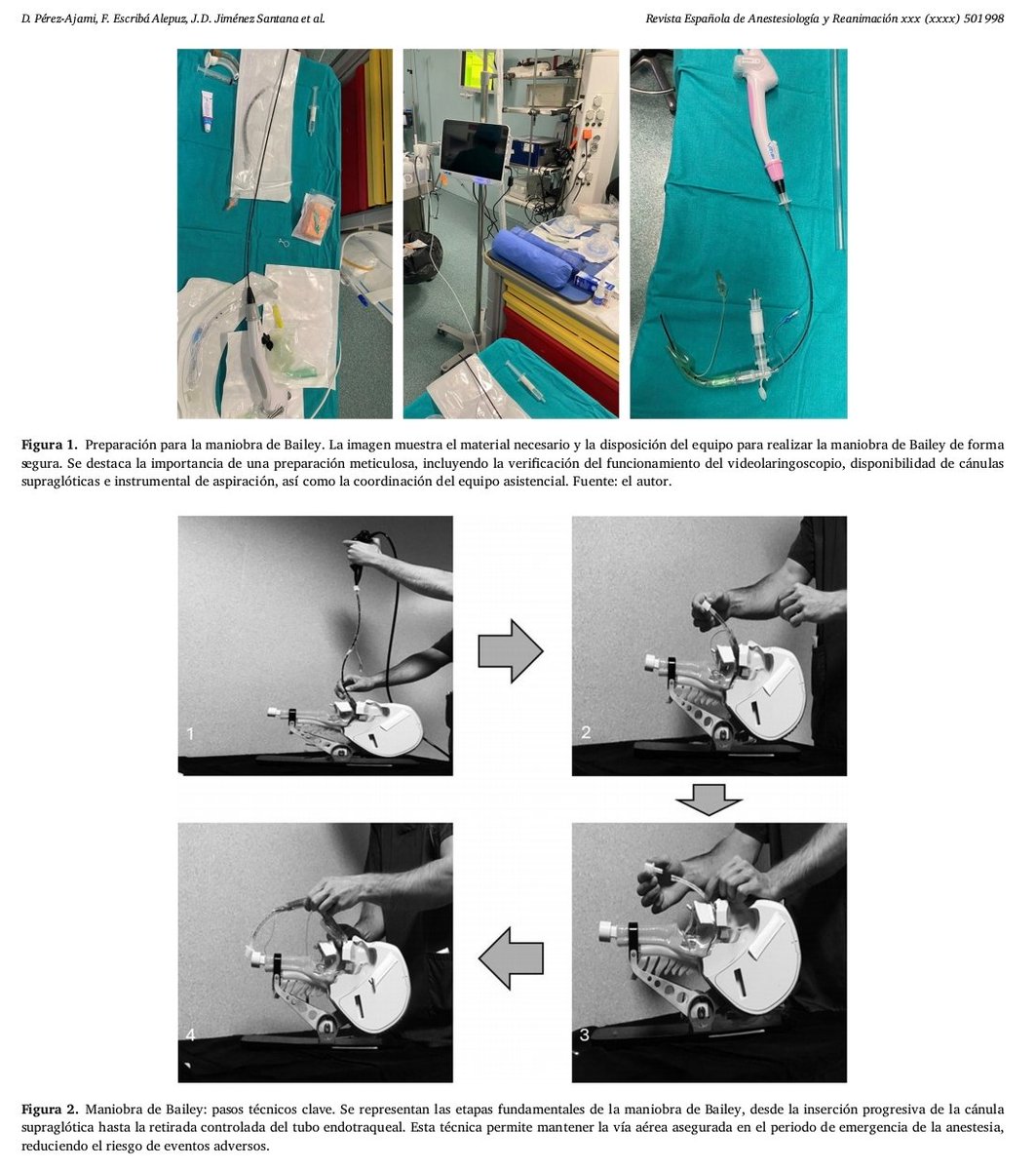 Revista Española de Anestesiología y Reanimación tweet media