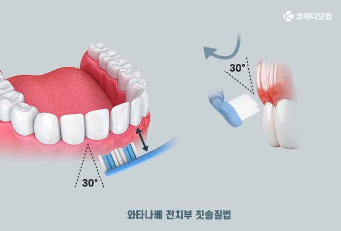 와타나베 칫솔법
치아 사이에 칫솔모 끼우는건데...와타나베씨 믿어볼게요....