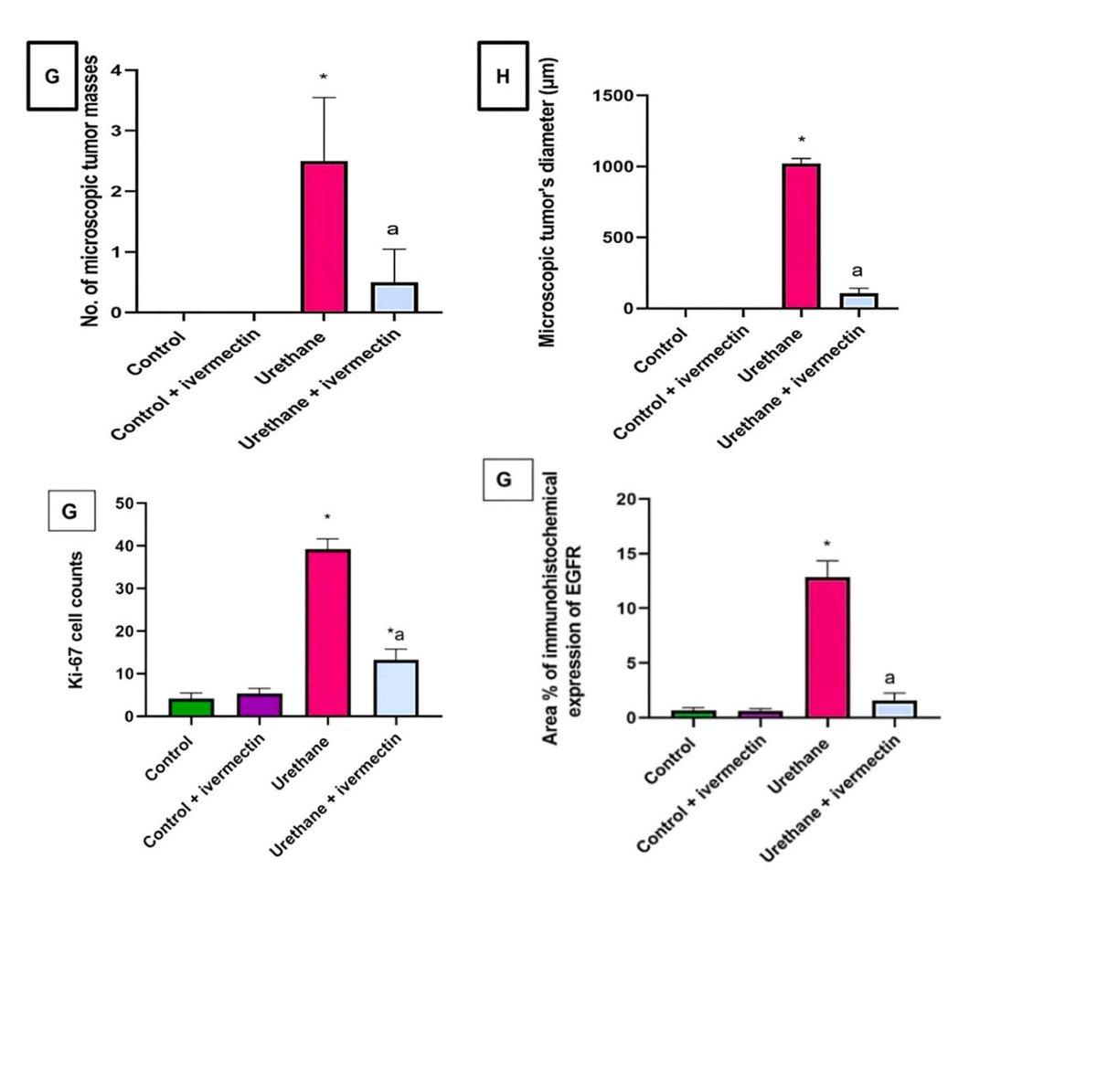 MakisMedicine's tweet image. BREAKING NEWS: 2025 Paper from Middle East identifies how Ivermectin kills Lung Cancer cells!

In 2025, Malak et al. with a team from UAE, Egypt and Saudi Arabia, published a paper on Ivermectin in Lung Cancer

The researchers created lung cancer in immune-normal BALB/c mice by…