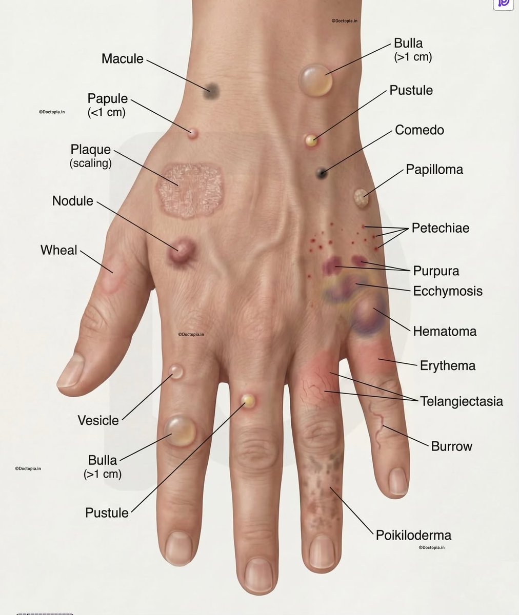 OGdukeneurosurg's tweet image. Skin lesions to know