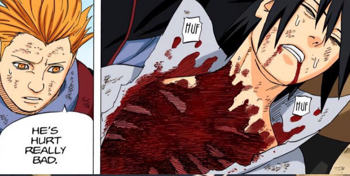 This always makes me laugh. “He’s hurt really bad” might be an understatement 😭