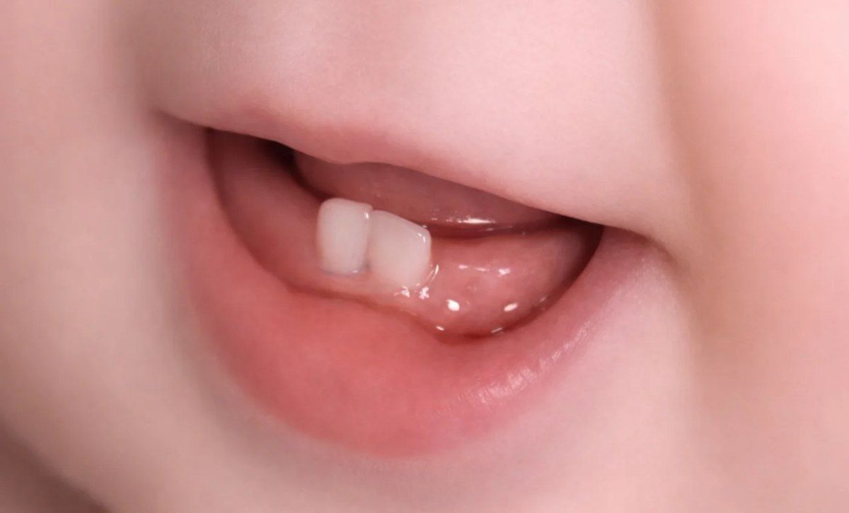 Don’t judge by cuteness it’s a finger hunter..😜 
Ever caught you?