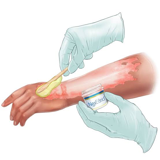 robydigi's tweet image. Volevo ricordare che i pazienti ustionati ricoverati al Niguarda, e a cui auguro ogni bene, siano trattati con NexoBrid dell'azienda #israeliana MediWound.
Chi lo segnala ai sindaci boicottatori dei farmaci #madeinIsrael nelle farmacie dei loro comuni?
#CransMontan