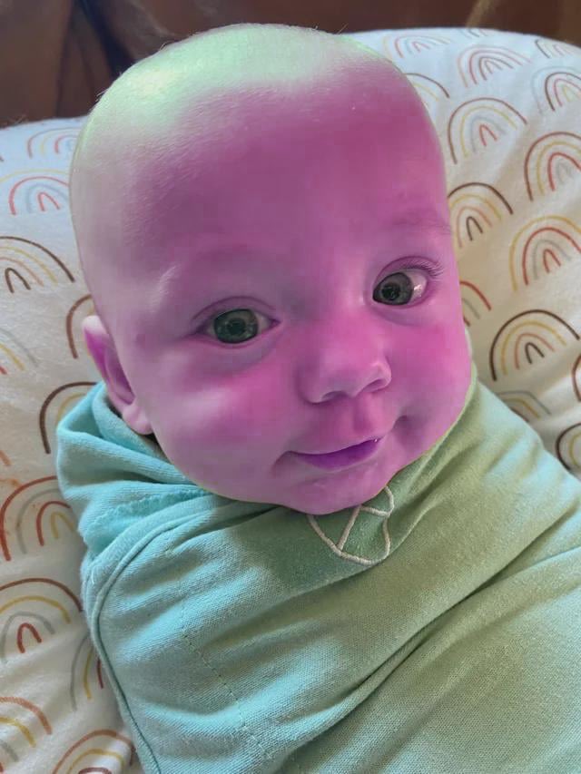 ditto_flareon's tweet image. Newton Memusson, the first American born in 2026, has a rare genetic disorder that causes the skin to be appear purple.