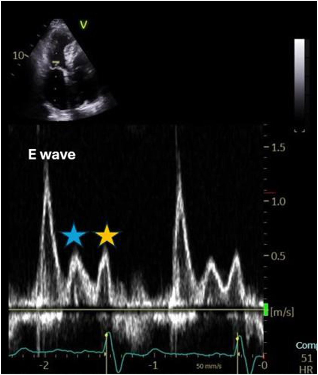 V.L.Sorrell, MD (@CASEfromASE EIC) tweet media