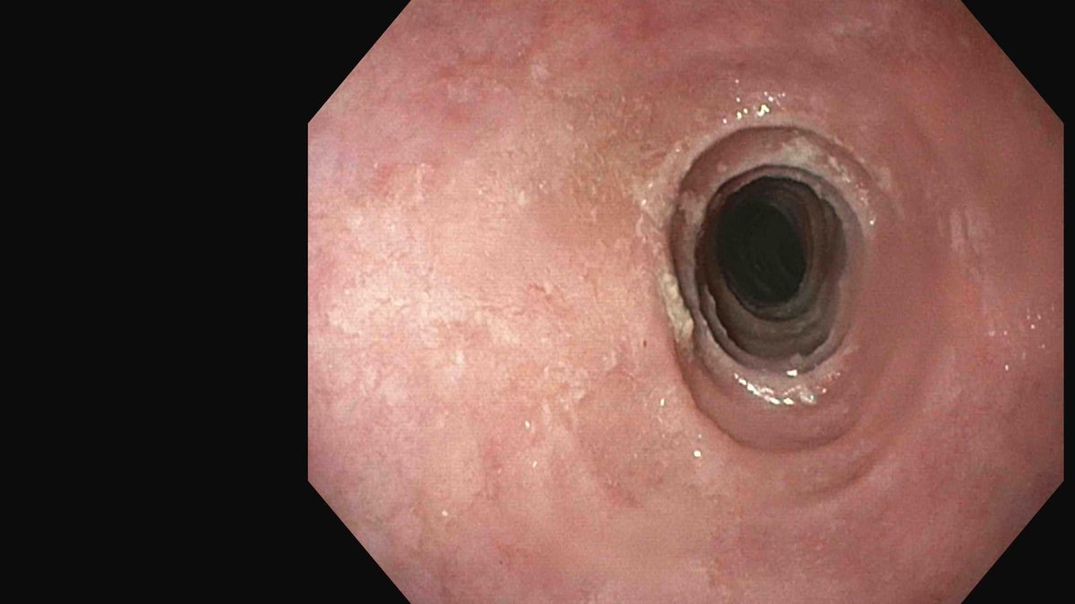 Douglas G. Adler MD, FASGE, FACG, AGAF tweet media