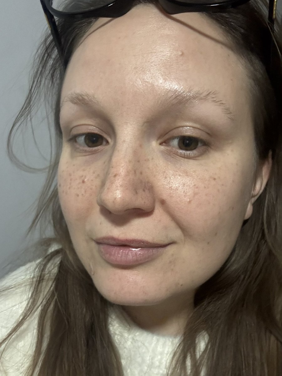 Зробила собі веснянки щоб натякнути температурі -30 та ожеледиці, що вони зайві