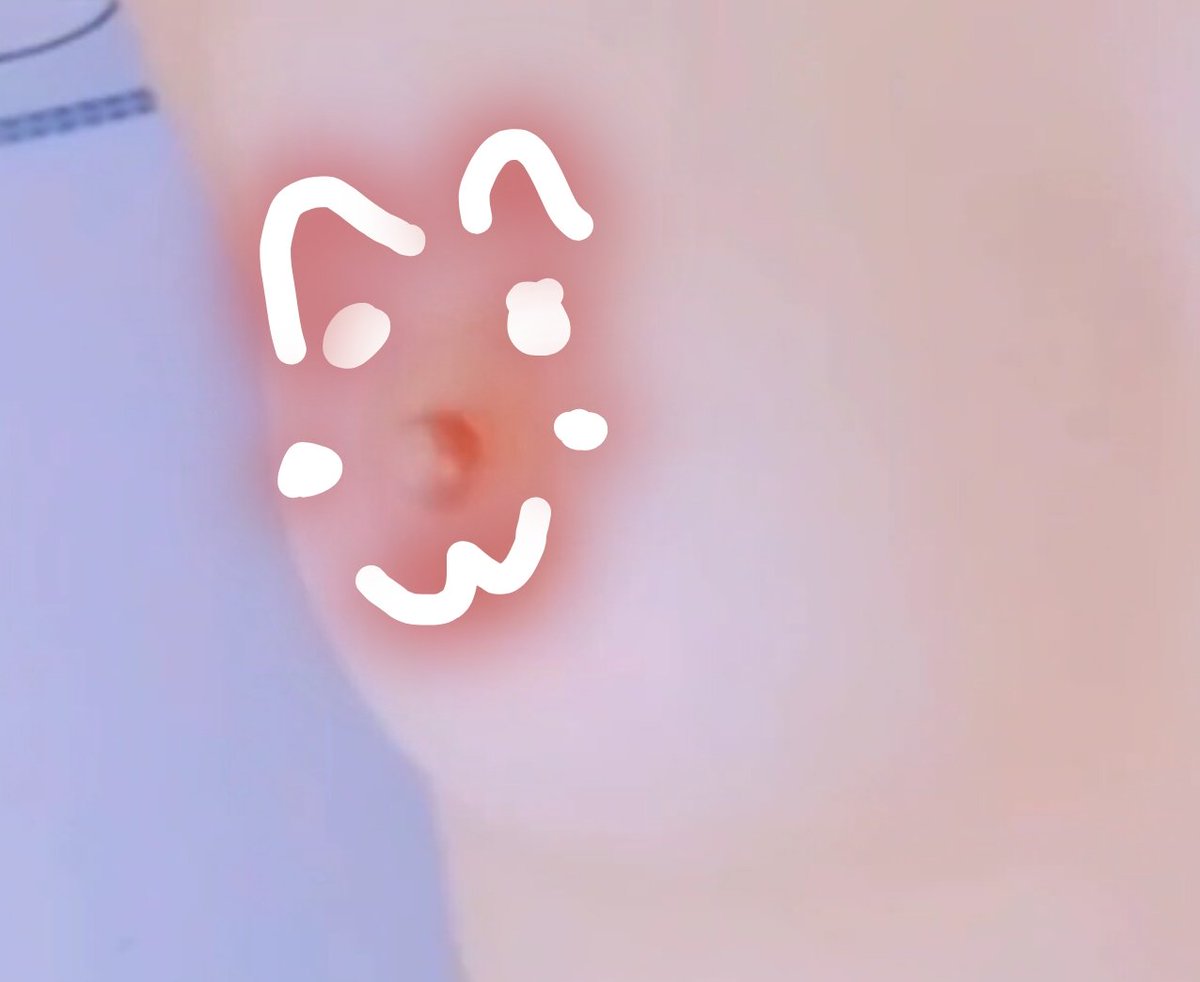 Chem Chép K Lông ❤️‍🔥 tweet media