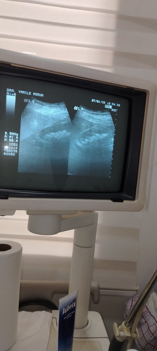 Rebeca_78's tweet image. controlarla. Por el momento tengo mucho dolor y náuseas. Ya no cuento con los recursos para este tratamiento. Si puedes ayudarme con los gatos médicos, incluso con un RT te lo agradecería mucho. 🙏🏼