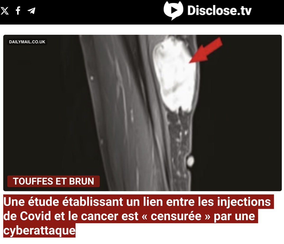 NiONiPardon's tweet image. 📌 Une étude établissant un lien entre les injections de Covid et le cancer est « censurée » par une cyberattaque.

disclose.tv/id/63ece33cuo/