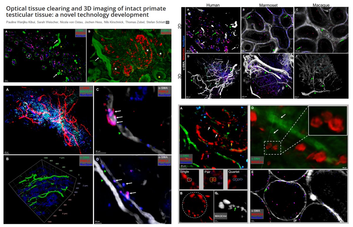 Whole-mount staining of primate testis

Human Marmoset Macaque
Bouin's PFA fixative
0.5~50 mm³

PT-CLEAR3D staining
BABB optical clearing

Germ cell: MAGE-A4 PIWIL4
Sertoli: Vimentin Sox9
Peritubular myoid cell &amp; Blood Vessel: α-SMA

<a href="/kibui_pauline/">Dr. Kibui Pauline</a> <a href="/PLOSONE/">PLOS One</a> 2025