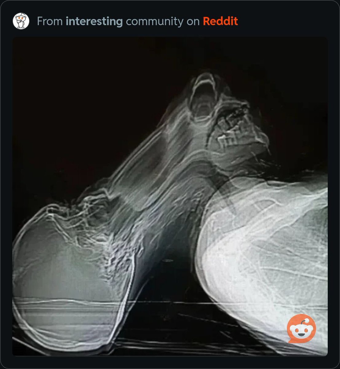 This is the closest visual to how it feels like my soul is leaving my body as I watch children being burned alive by the Israeli army.