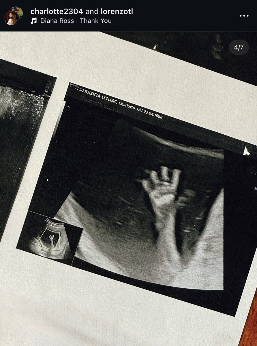 OMG THE FIRST LECLERC BABY