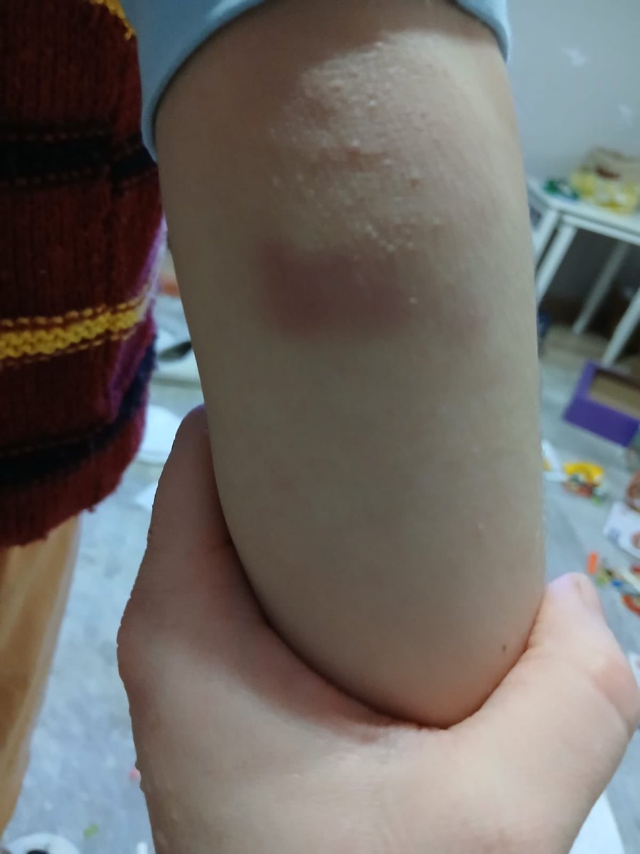 #SONDAKİKA 
#ÖZEL - İstanbul Tuzla’daki bir ilköğretim okulunda skandal!

7 yaşındaki öğrencinin annesi Z.D.“Öğretmen, çocuğunuz hasta, tedavi görmesi gerekiyor, ilacını içirdiniz mi? gibi sorular sorarak sürekli baskı altında tuttu bizi, yönlendirdikleri psikiatriste gittik,