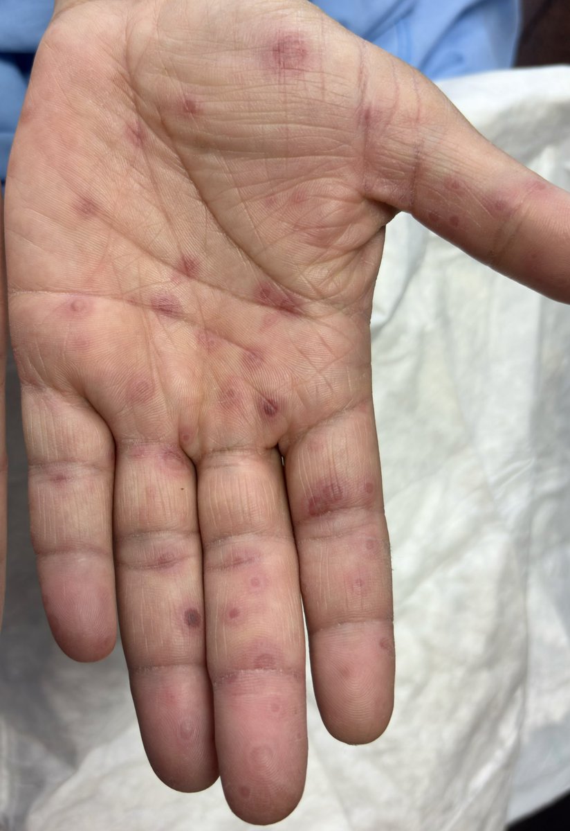 Hacía tiempo que no veía unas 🎯🎯🎯 tan perfectas