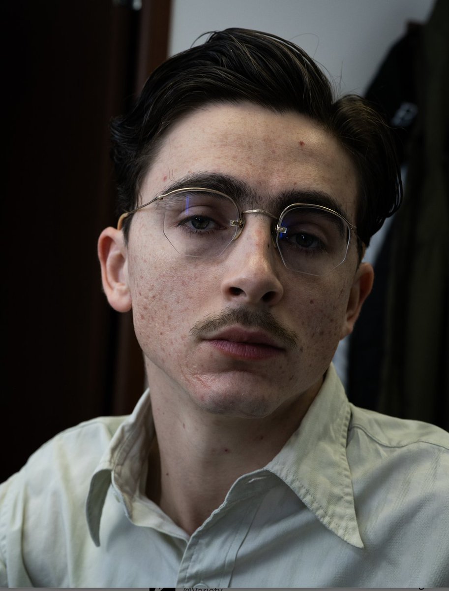 Variety's tweet image. Timothée Chalamet wore five prosthetics in #MartySupreme, as Josh Safdie wanted him to have “acne scars, keloid scars, like he’s been in some fights.”

“There were large pieces that covered his cheeks to give the acne-pockmarked skin texture. He had another piece on his cheekbone…