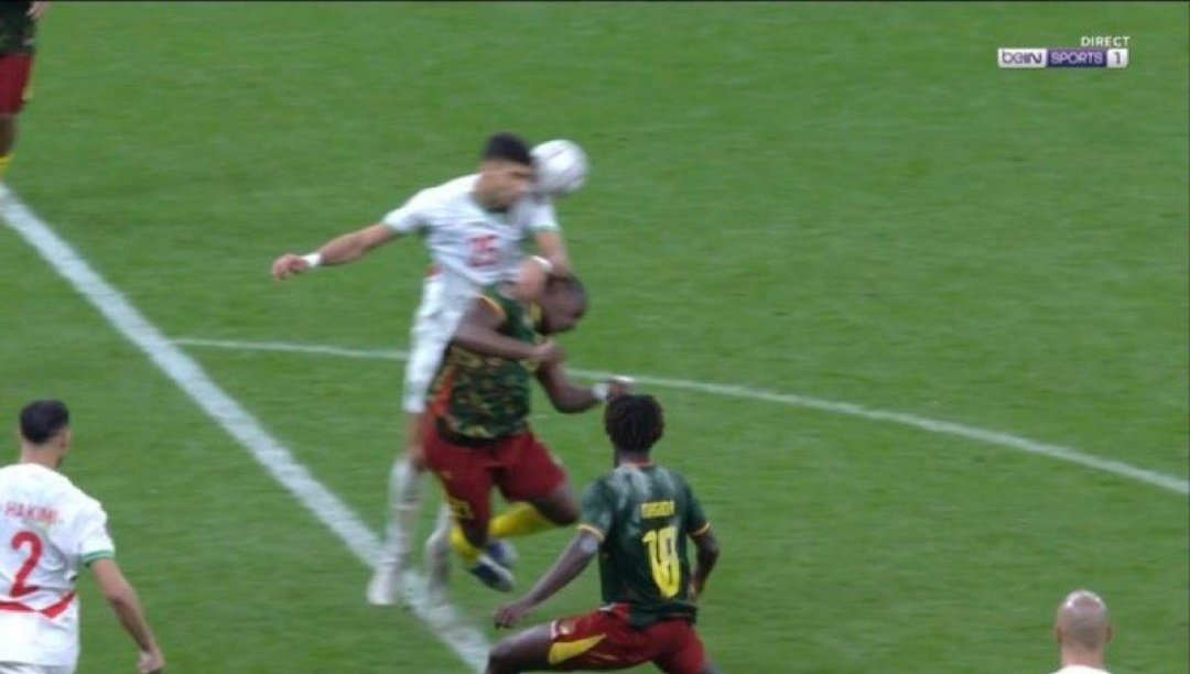 Messiah Yaniss 🇨🇵🇩🇿🇸🇳 tweet media