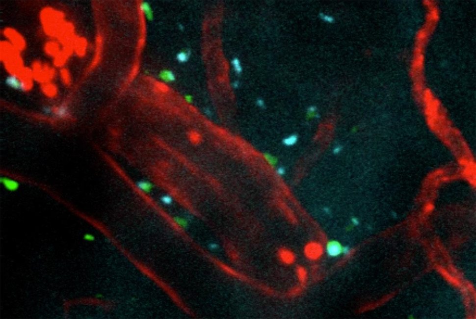 NUChemistry's tweet image. Stroke recovery could get a boost: @NorthwesternU  researchers developed injectable “dancing molecules” that cross the blood-brain barrier, reduce damage, and support repair. Chemistry + medicine + engineering at work. #StrokeRecovery #Nanotechnology 
🔗 bit.ly/4qLZYvx