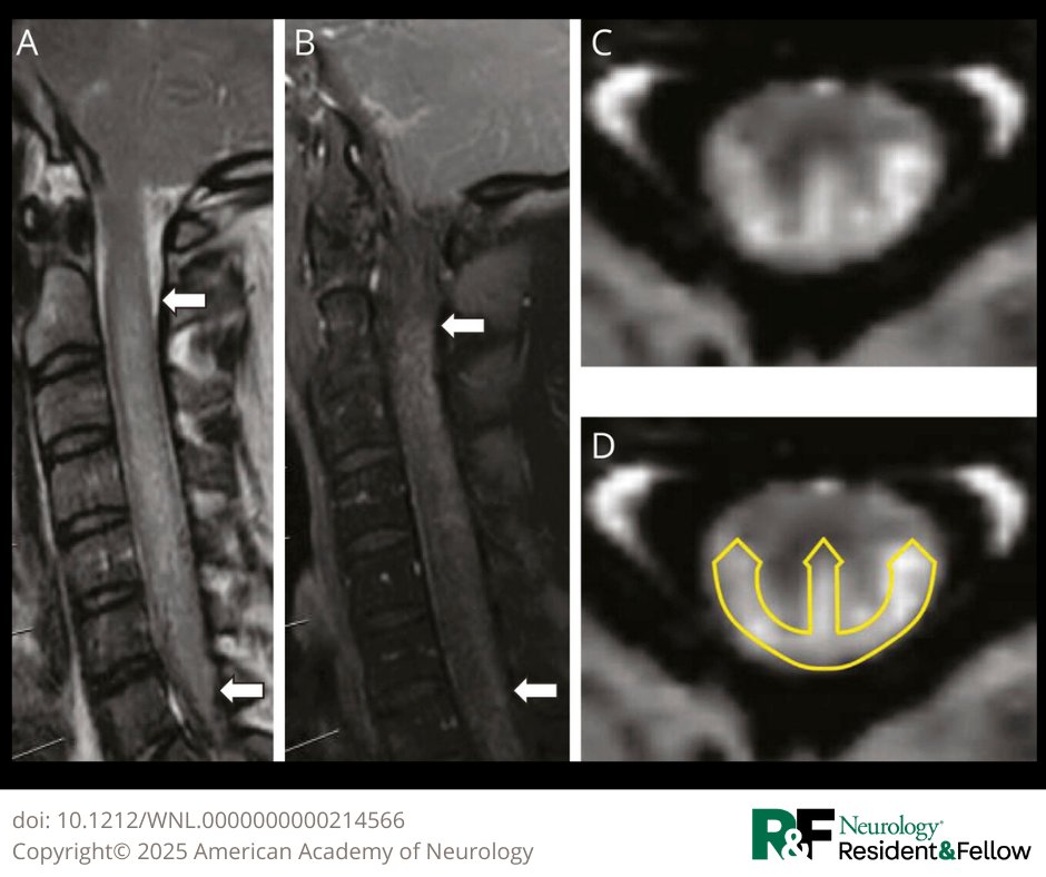 Neurology Journal tweet media