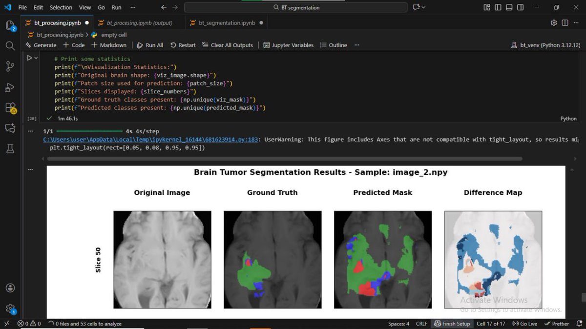 bbnellyy's tweet image. Just wrapped up the "Lightweight Brain Tumor Segmentation on Low-Resource Systems" tutorial by @mailab_io.
Built a 3D U-Net for brain tumor segmentation on BraTS-Africa 2024 dataset, Streamlit demo included below.
#BraTSAfrica #MedicalAI #Unet #LowResourceAI