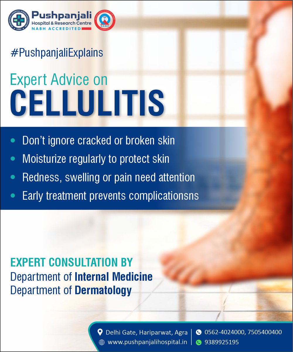 PHRCAGRA's tweet photo. Cracked skin in winter may signal a higher risk of Cellulitis

At @PHRCAGRA, our specialists from the Departments of Internal Medicine and Dermatology emphasize early evaluation, proper skin care and prompt treatment. 
Call Now - 7505 400 400 | 9389 925 195
#follow #like #share https://t.co/SwMWQhQTE6