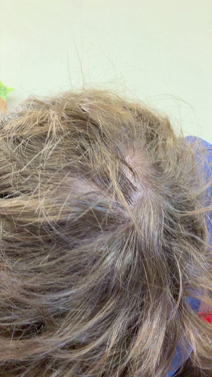 evh_99's tweet photo. Before Haircut https://t.co/0iul728DOo