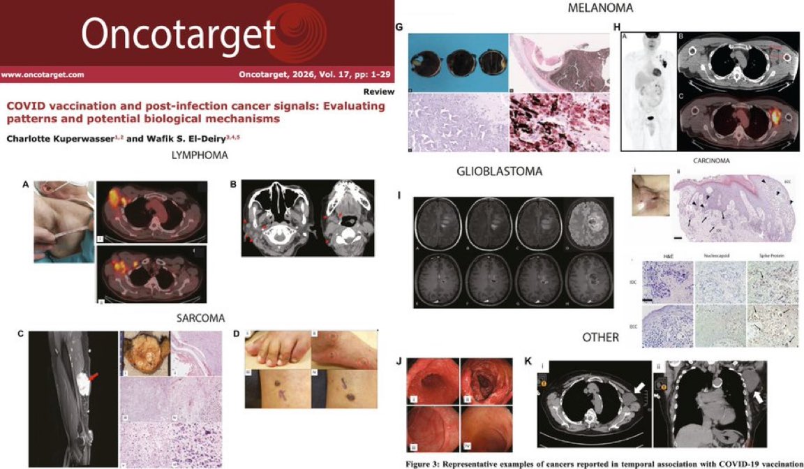 liz_churchill10's tweet image. You know it’s bad when there’s a Cyber Attack on a Medical Journal that published a study proving the ‘Covid Vaccines’ cause cancer.