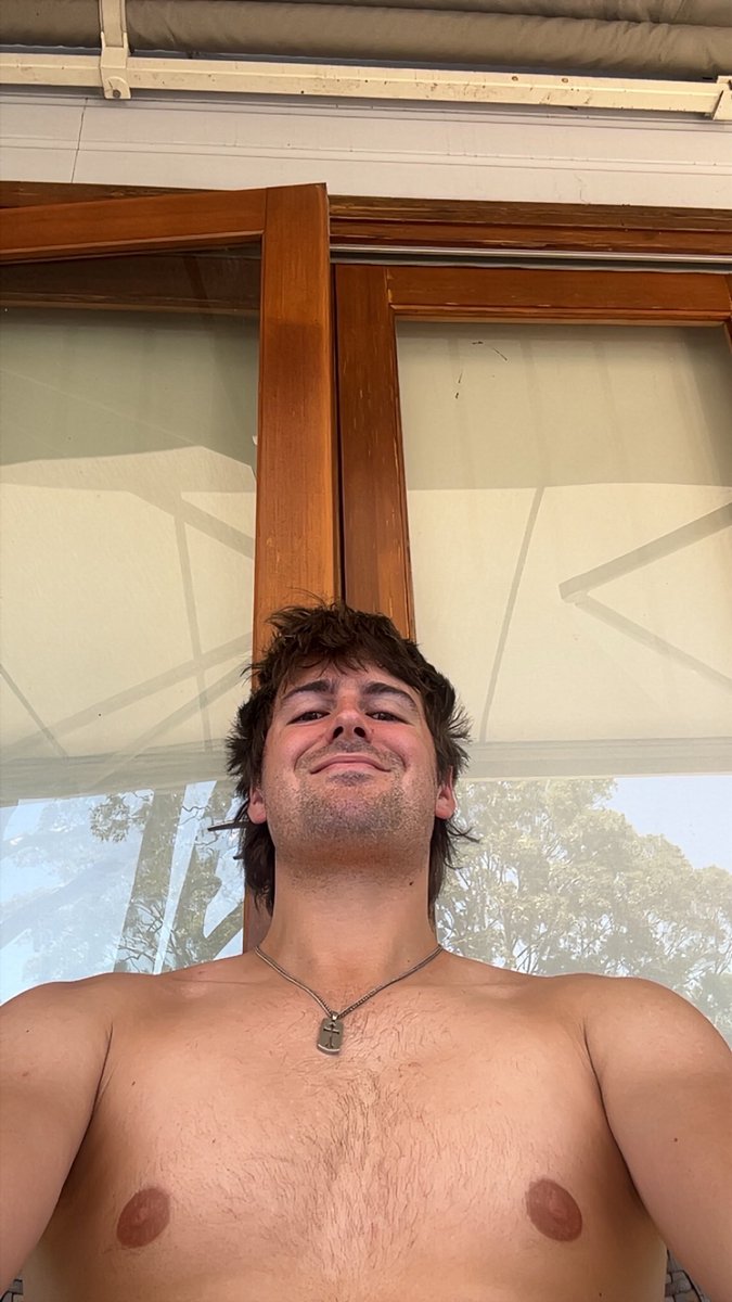 Forgot sunnies on a 40 degree days it’s over