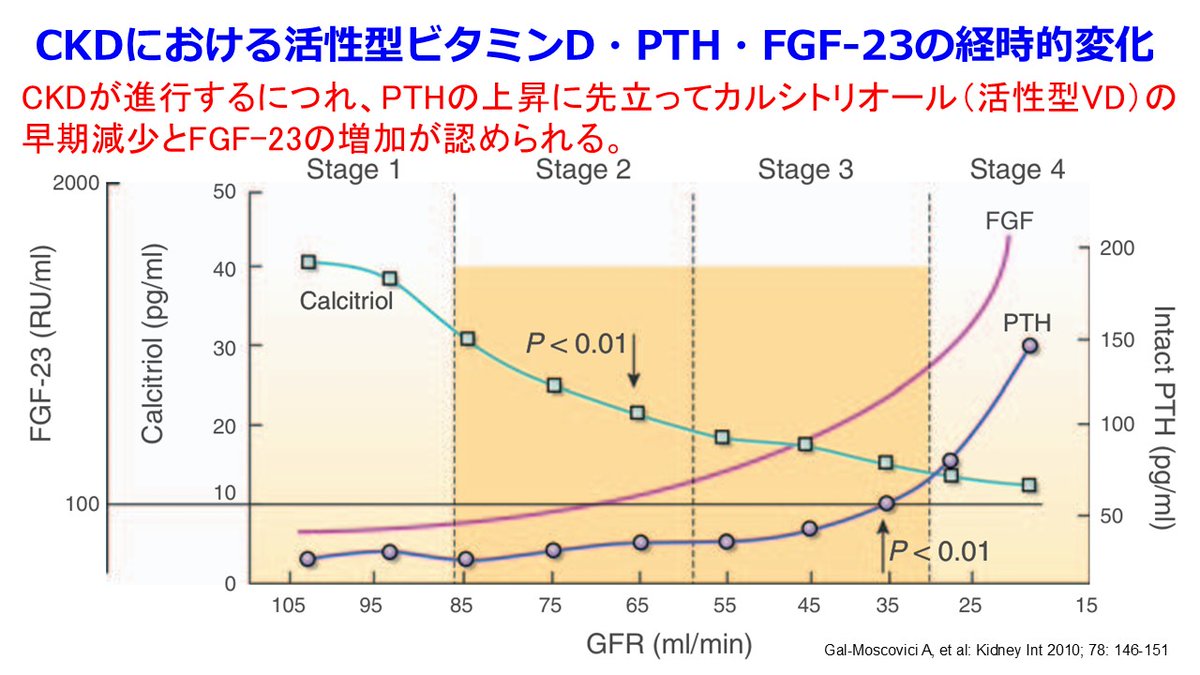 Jun_Hirosena's tweet photo. 非透析日にアダラートCRのような強力な降圧薬、透析日には降圧薬を中止してリズミックの処方はなんで？
同じ患者に降圧薬と昇圧薬が処方されたら、新人薬剤師は混乱してしまうだろうね。でも透析患者ではふつうにみられることだ。結論から言おう。透析患者の多くは血管石灰化が進行しており、脈圧の増大と強く関連しているからだ。脈圧＝収縮期血圧－拡張期血圧だけど、これは心機能の低下した後期高齢者に多いが、透析患者ではこれが若年者でも起こりやすく、心血管イベントや死亡のリスクを高める重要な要因になっている。
その原因はCKD－MBD（慢性腎臓病に伴う骨・ミネラル代謝異常）によることが多い。腎機能が低下すると、腎におけるリン排泄能が低下しリン利尿ホルモンのFGF-23の産生が亢進し、腎におけるビタミンDの活性化を障害して高リン血症・低Ca血症状態が持続する。そのためPTHの分泌が亢進して骨を溶かして血清Ca値を上げるから骨がスカスカになって線維性骨炎になり、血管では石灰化が亢進する。健常者でも内膜の石灰化は起こるが透析患者の血管石灰化は血管の中膜にヒドロキシアパタイト、つまり骨ができる（メンケベルク型の動脈硬化）。血管が骨のように硬くなるから高血圧は必発！これを防ぐにはPTHが上がらないようにリン・Caのコントロール、そしてPTHをオルケディアⓇのようなCa受容体作動薬（カルシミメティクス）と活性型ビタミンD（VD受容体作動薬）によって下げるけど、これらの治療がうまくいっていない方は動脈の弾力性が全く失われる。だから心収縮によって生じた圧を動脈が吸収しきれない（血管進展性が不良になっている）から収縮期血圧は非常に高くなるが、その結果、拡張期血圧は低くなって脈圧が増大する。透析中に体外循環・除水によって循環血漿量が減少すると血管コンプライアンスが低いので、一転して著明な低血圧になる。低血圧ショックにならないよう、昇圧薬を投与せざるを得なくなるんだ。CKD－MBDの新ガイドライン2025ではPとCa管理はPTH管理より優先し、Ca 9.5未満、P 5.5mg/dL未満と厳しくなったことも知っておこう。