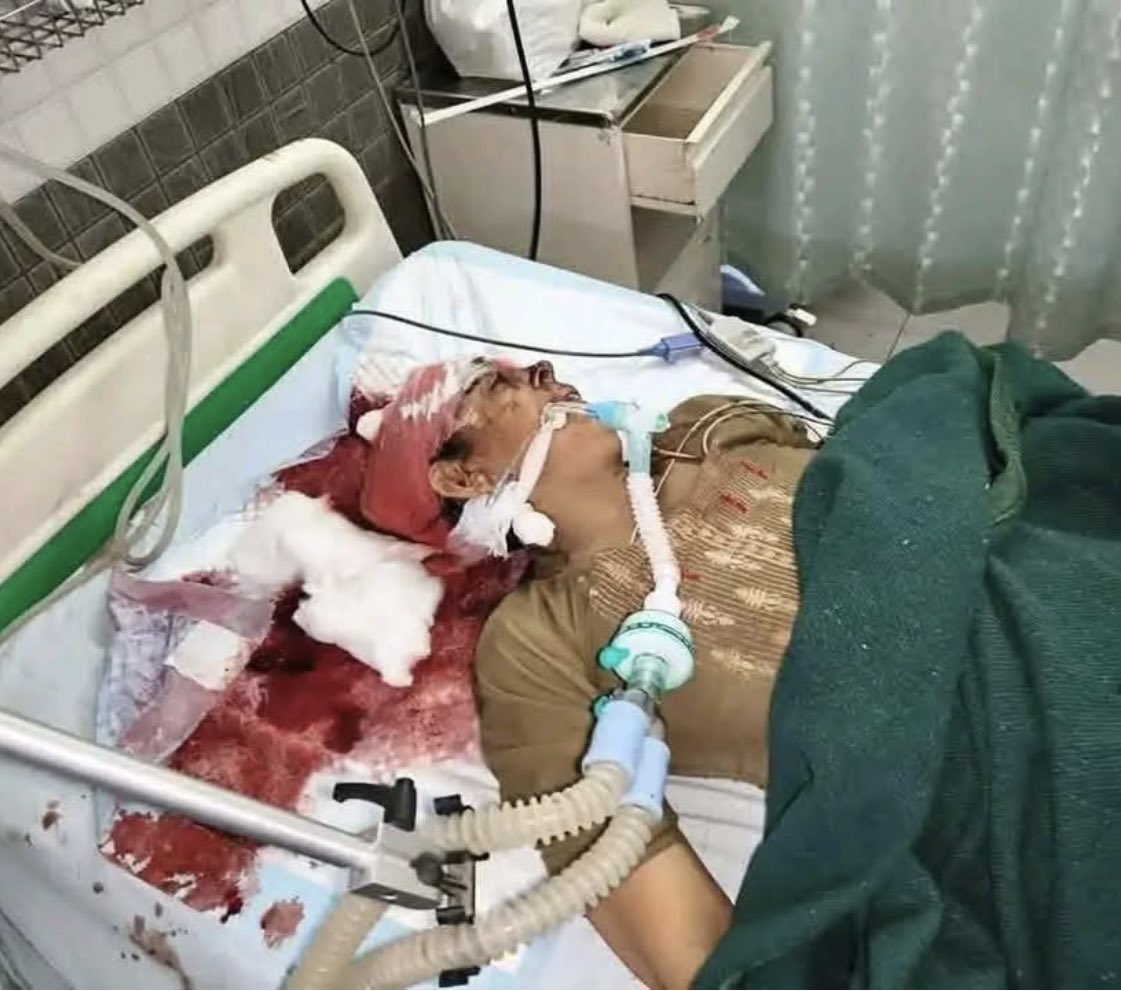 मेरठ के कपसाड़ गांव में एक दलित महिला खेत जाने के लिए अपनी बेटी के साथ घर से निकली थी.

माँ की हत्या करके बेटी का अपहरण कर लिया गया.

इस घटना को करीब 48 घंटे हो चुके हैं, लेकिन लड़की का कुछ पता नही लग सका है. 

अगर यही रामराज है तो रावणराज किसे कहेंगे?