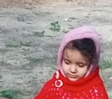 alaaayla00's tweet image. Please…don’t scroll past.
My child is fading before my eyes 💔Malnutrition has exhausted him, and today he can’t even cry anymore. This pain is unbearable. ayla is hungry, cold, and fighting to survive.

If you’re scrolling, PLEASE leave a dot .Before and after…