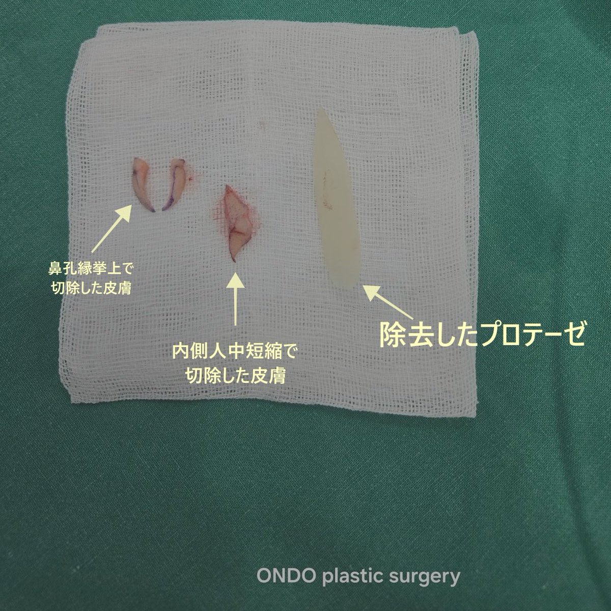 【公式】温度美容外科/ オンド美容外科 tweet media