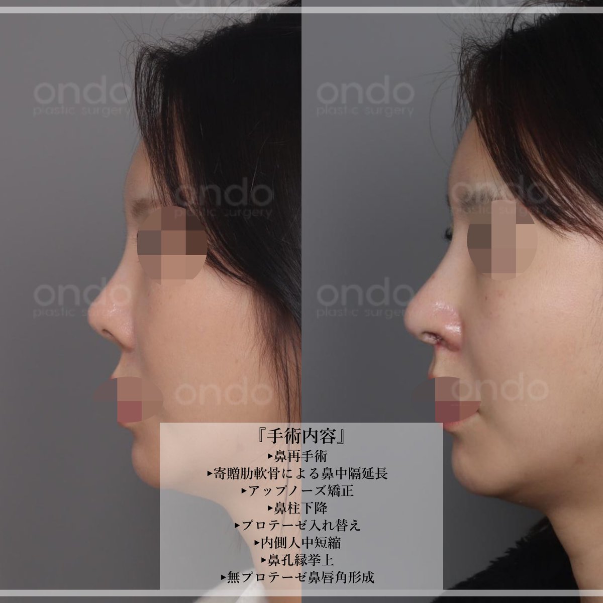 【公式】温度美容外科/ オンド美容外科 tweet media