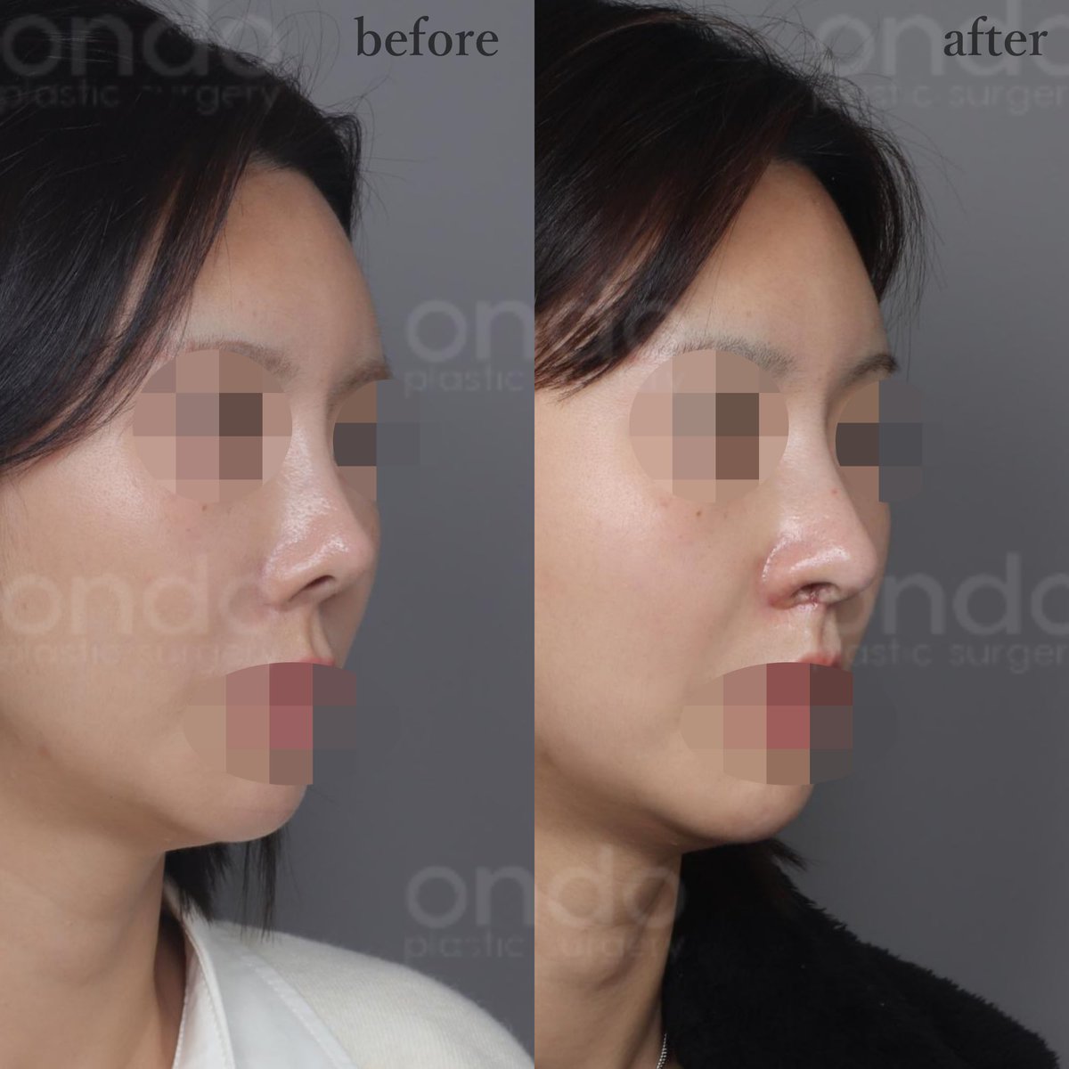 【公式】温度美容外科/ オンド美容外科 tweet media