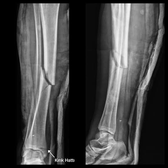 Bu akşamki beklentim ektedir 🙏🙏